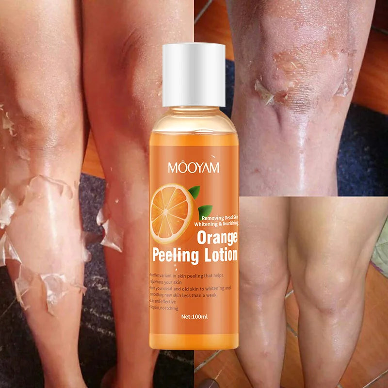 Natural Orange Peeling Oil For Dark Skin Moisturizing